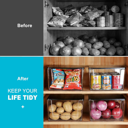 Pantry Organizers Storage, 2 Pack Large Clear Storage Bins for Onion, Potato, Garlic, Canned Food, Organizer Bins for Under Sink, Kitchen, Countertop, Bathroom